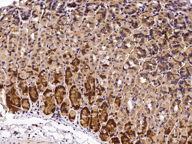 Growth Hormone Receptor Antibody in Immunohistochemistry (Paraffin) (IHC (P))