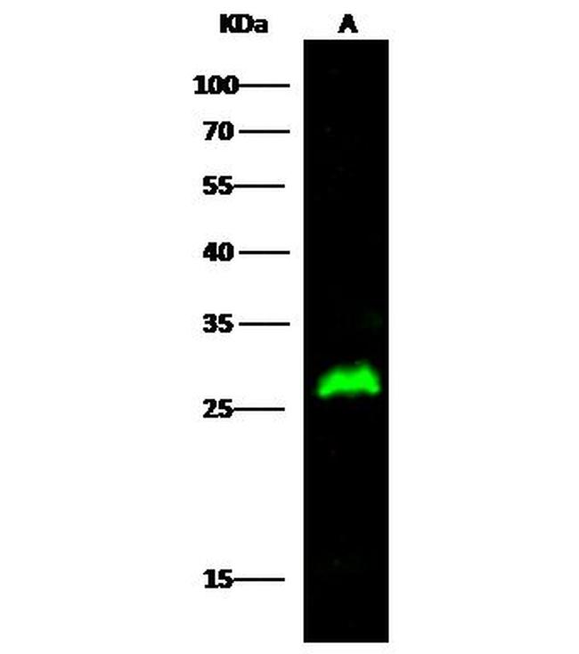 15-PGDH Antibody in Western Blot (WB)