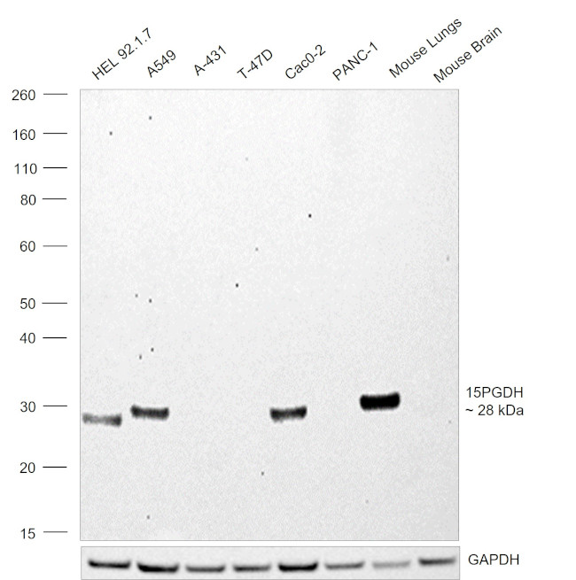 15-PGDH Antibody in Western Blot (WB)