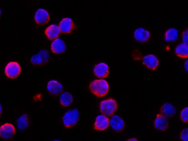 IFNAR1 Antibody in Immunocytochemistry (ICC/IF)