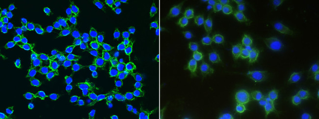 LDLR Antibody in Immunocytochemistry (ICC/IF)