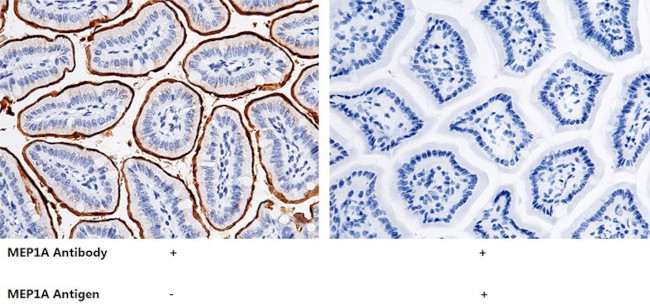 MEP1A Antibody in Immunohistochemistry (Paraffin) (IHC (P))