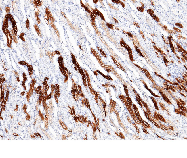 MEP1A Antibody in Immunohistochemistry (Paraffin) (IHC (P))