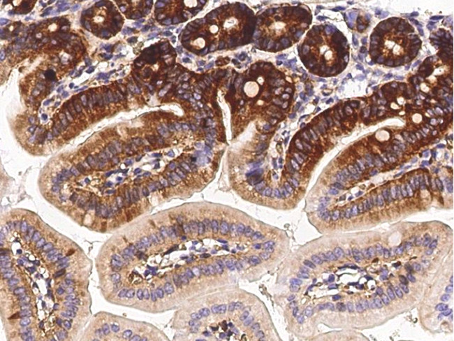 METAP2 Antibody in Immunohistochemistry (Paraffin) (IHC (P))