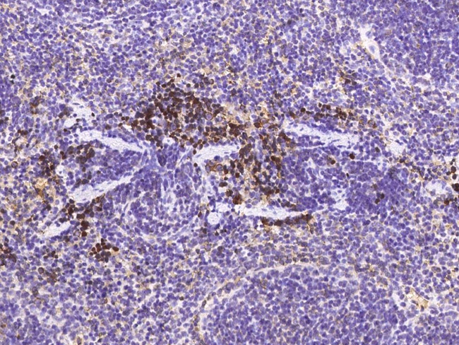 METAP2 Antibody in Immunohistochemistry (Paraffin) (IHC (P))