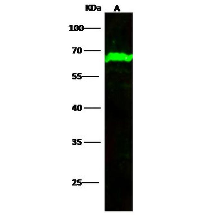 METAP2 Antibody in Western Blot (WB)