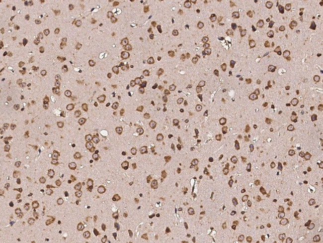 PDI Antibody in Immunohistochemistry (Paraffin) (IHC (P))