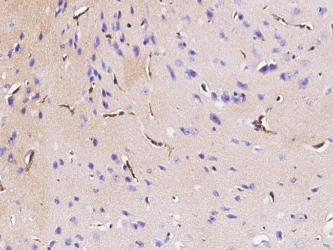 Podoplanin Antibody in Immunohistochemistry (Paraffin) (IHC (P))