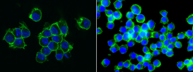 CD155 Antibody in Immunocytochemistry (ICC/IF)