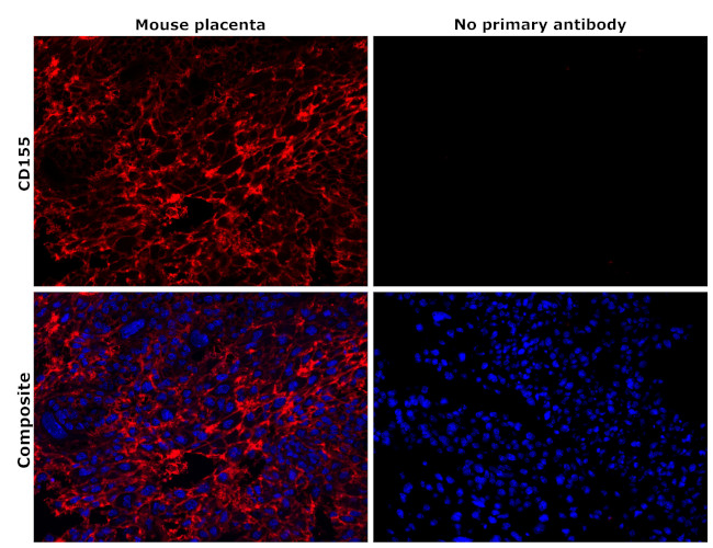 CD155 Antibody in Immunohistochemistry (Paraffin) (IHC (P))