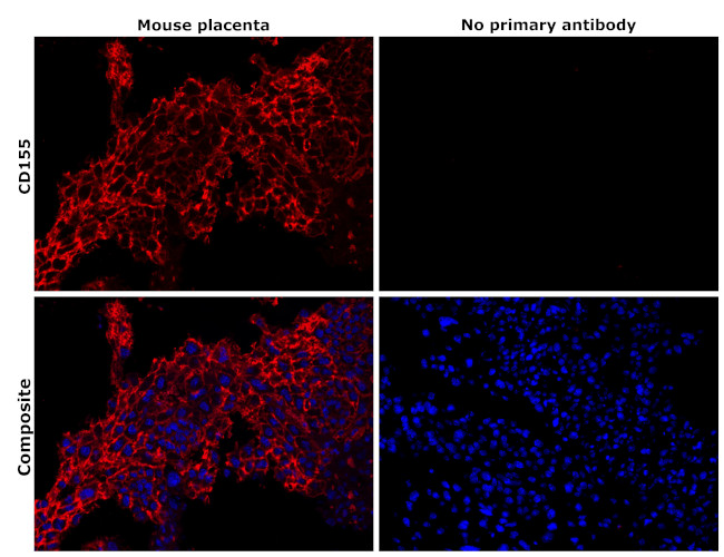 CD155 Antibody in Immunohistochemistry (Paraffin) (IHC (P))