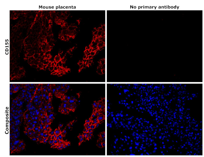 CD155 Antibody in Immunohistochemistry (Paraffin) (IHC (P))