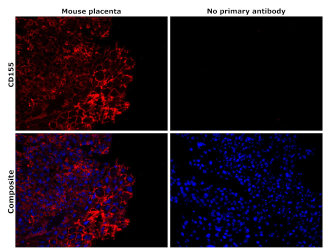 CD155 Antibody in Immunohistochemistry (Paraffin) (IHC (P))