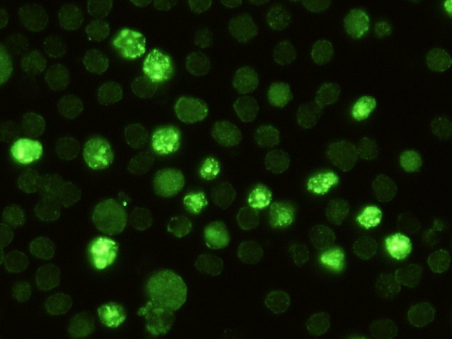 RBP4 Antibody in Immunocytochemistry (ICC/IF)