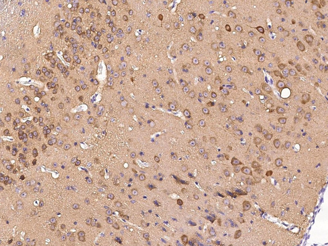 S100A5 Antibody in Immunohistochemistry (Paraffin) (IHC (P))