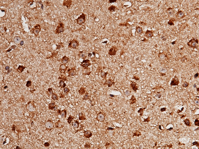 LIMP2 Antibody in Immunohistochemistry (Paraffin) (IHC (P))