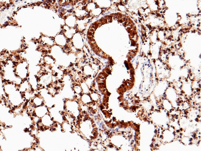 SFTPD Antibody in Immunohistochemistry (Paraffin) (IHC (P))