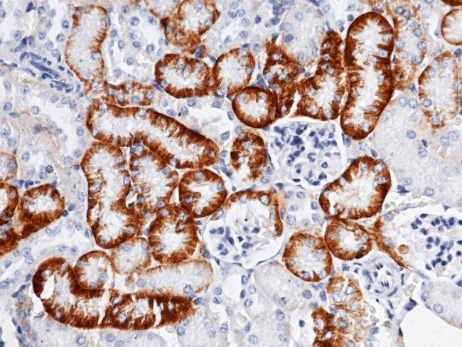 CD98 Antibody in Immunohistochemistry (Paraffin) (IHC (P))