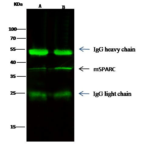 SPARC Antibody in Immunoprecipitation (IP)