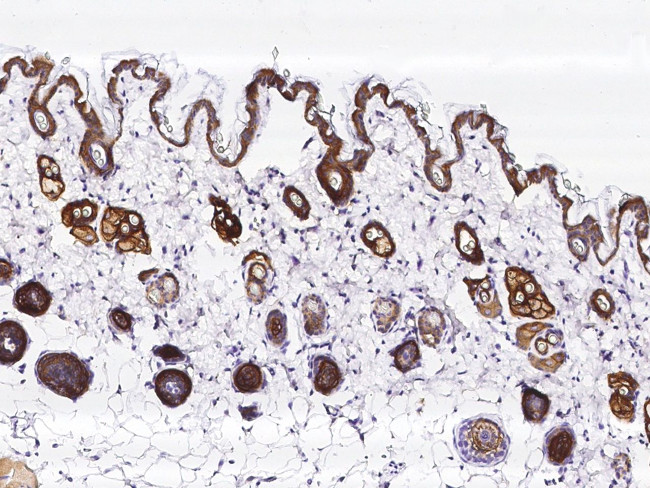 TROP2 Antibody in Immunohistochemistry (Paraffin) (IHC (P))