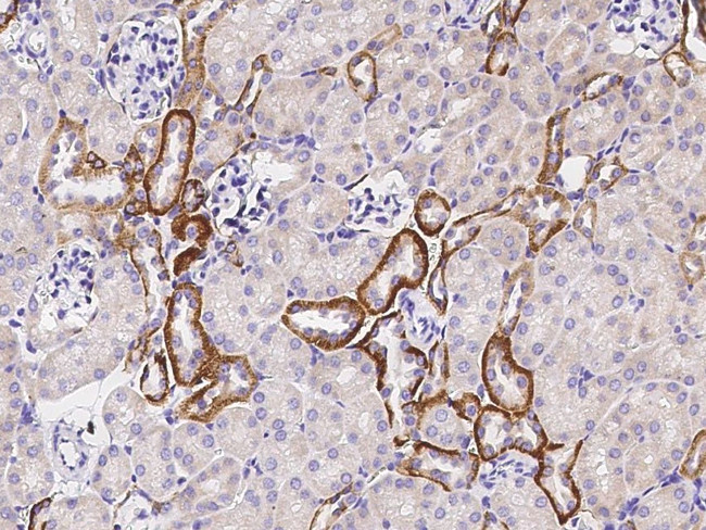 TROP2 Antibody in Immunohistochemistry (Paraffin) (IHC (P))