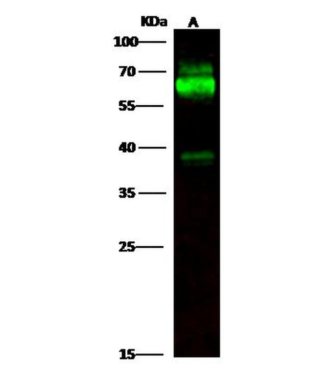 Tyrosine Hydroxylase Antibody in Western Blot (WB)