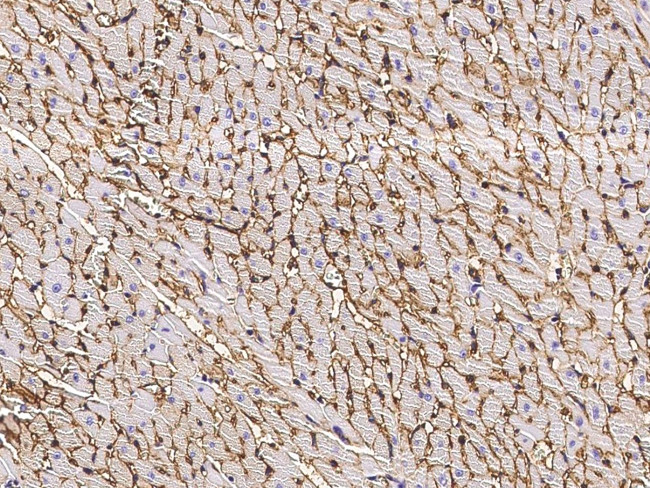 CD36 Antibody in Immunohistochemistry (Paraffin) (IHC (P))