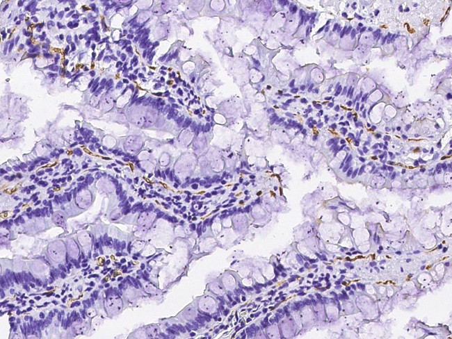 CD36 Antibody in Immunohistochemistry (Paraffin) (IHC (P))