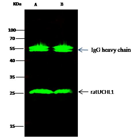 PGP9.5 Antibody in Immunoprecipitation (IP)