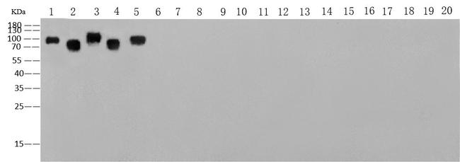 Influenza B HA Antibody in Western Blot (WB)