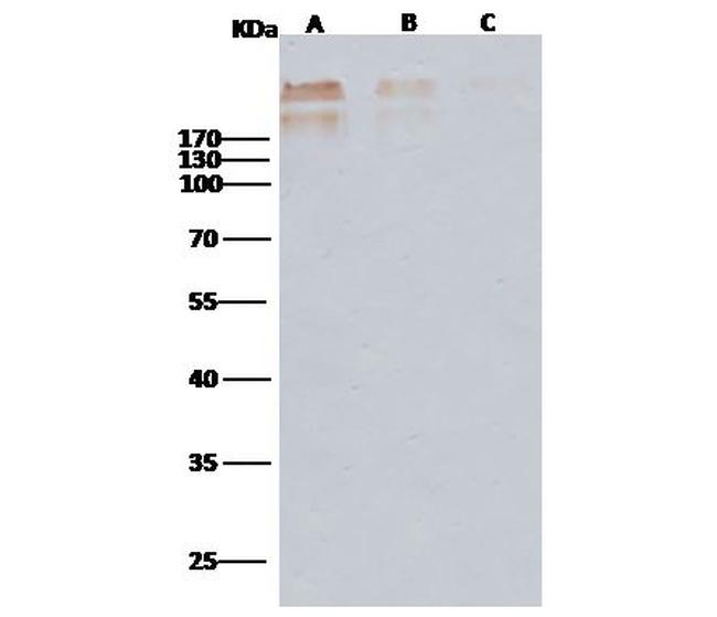 Cytomegalovirus gB Late Antigen Antibody in Western Blot (WB)