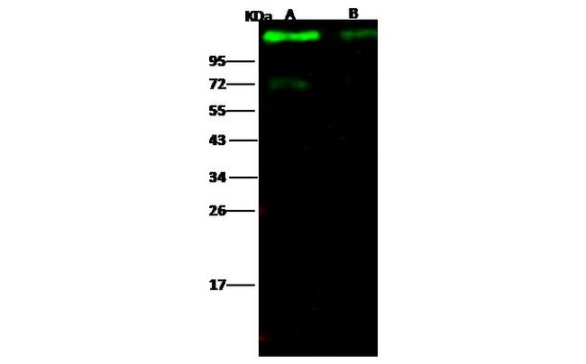 Ebola Virus GP1 (mucin domain deleted) (subtype Sudan, strain Gulu) Antibody in Western Blot (WB)