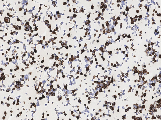 SARS/SARS-CoV-2 Nucleocapsid Antibody in Immunocytochemistry (ICC/IF)