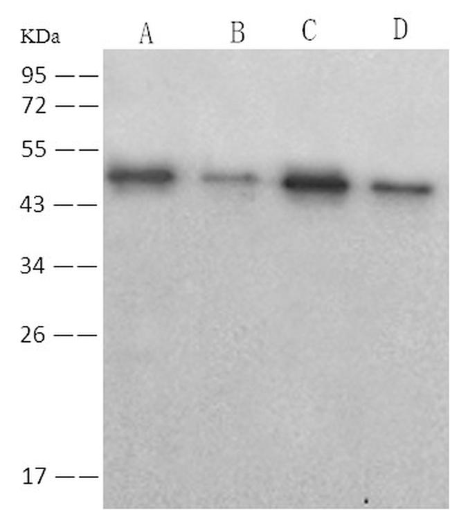 SARS/SARS-CoV-2 Nucleocapsid Antibody in Western Blot (WB)