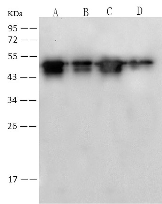 SARS/SARS-CoV-2 Nucleocapsid Antibody in Western Blot (WB)