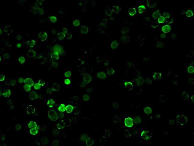 SARS/SARS-CoV-2 Nucleocapsid Antibody in Immunocytochemistry (ICC/IF)