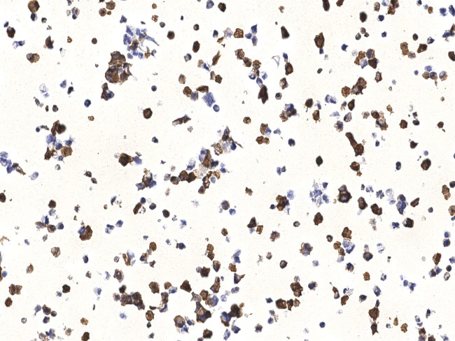 SARS/SARS-CoV-2 Nucleocapsid Antibody in Immunocytochemistry (ICC/IF)