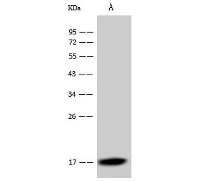 Dengue Virus Type 2 Capsid (strain New Guinea C) Antibody in Western Blot (WB)