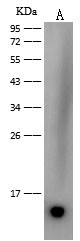 Dengue Virus Type 2 Envelope (Domain III) (strain New Guinea C/PUO-218 hybrid) Antibody in Western Blot (WB)