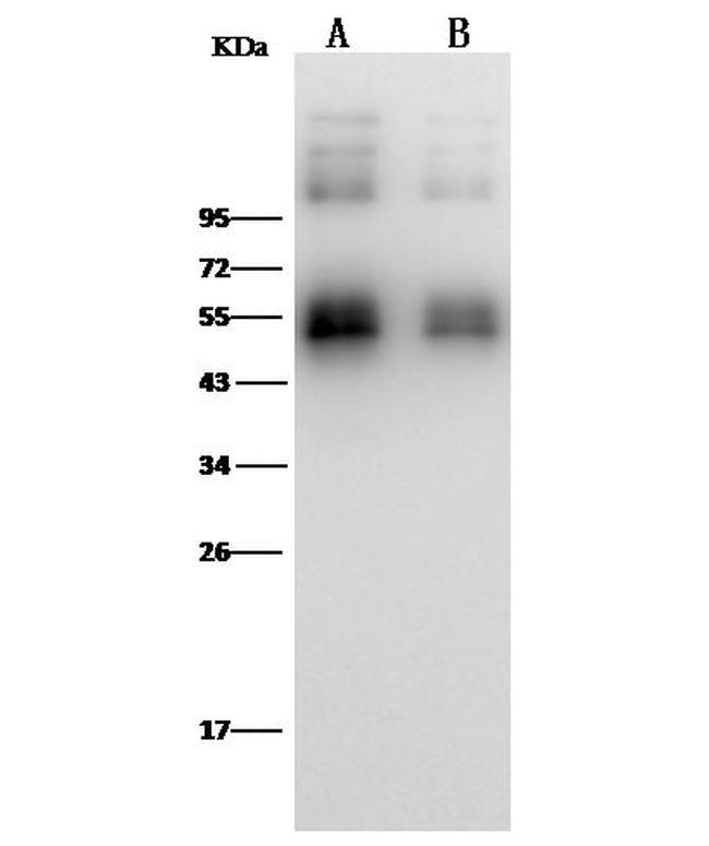 Zika Virus NS1 (strain Zika SPH2015) Antibody in Western Blot (WB)