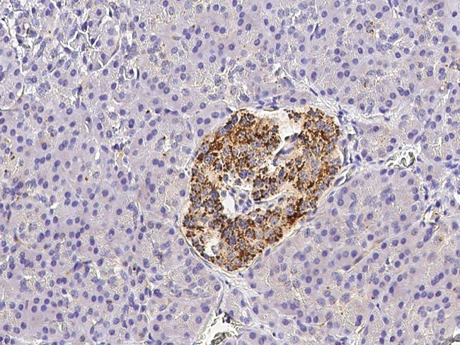 CX3CL1 Antibody in Immunohistochemistry (Paraffin) (IHC (P))