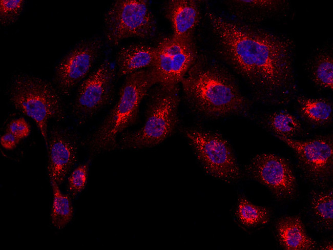 Cathepsin D Antibody in Immunocytochemistry (ICC/IF)