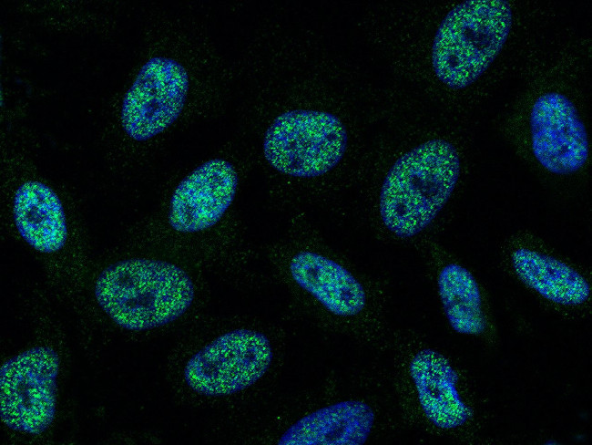 SAE1 Antibody in Immunocytochemistry (ICC/IF)