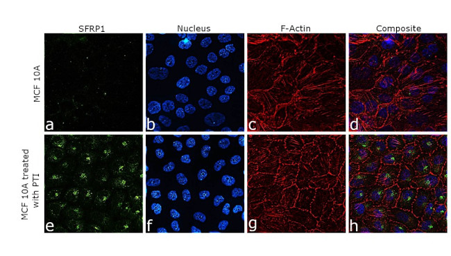 SFRP1 Antibody in Immunocytochemistry (ICC/IF)