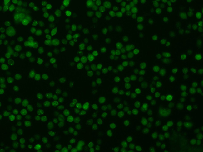 Oncostatin M Antibody in Immunocytochemistry (ICC/IF)