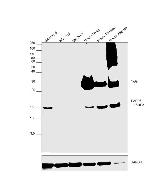 FABP7 Antibody in Western Blot (WB)