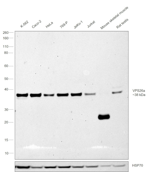 VPS26A Antibody in Western Blot (WB)