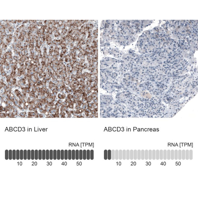 PMP70 Antibody