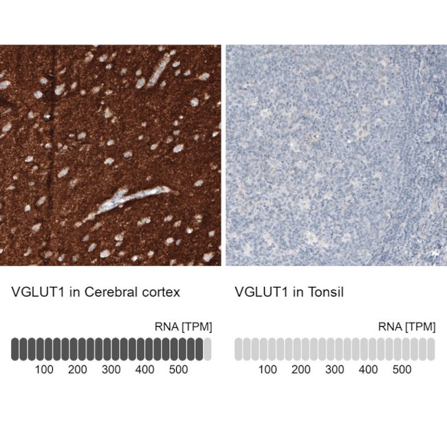 VGLUT1 Antibody