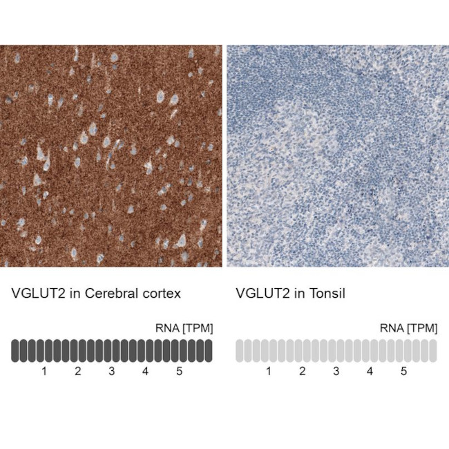 VGLUT2 Antibody